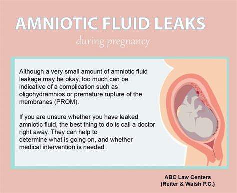 amniotic fluid sticky|Leaking Amniotic Fluid: Signs in 1st to 3rd Trimester